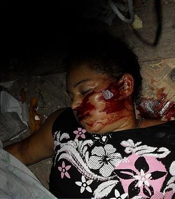 21-yo-woman-shot-01.jpg