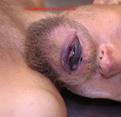 postmortem-drying-tongue-dark-discoloration-associated-mucosal-exposure-air..jpg