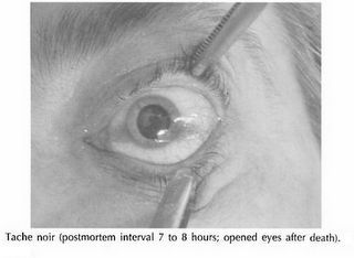 eye-change.jpg