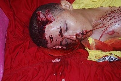 15-yo-male-shot-03.jpg