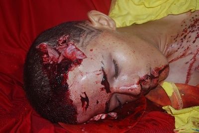 15-yo-male-shot-04.jpg