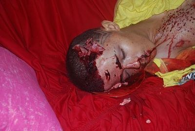 15-yo-male-shot-05.jpg