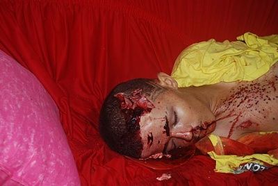 15-yo-male-shot-06.jpg