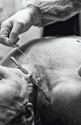 sewing-up-neck.jpg