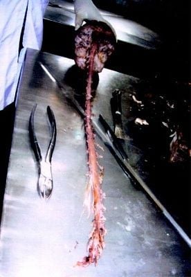 intact-20brain-2c-20spinal-20cord-2c-20caudaequina-20with-20its-20meninges-20and-20nerve-20roots.jpg
