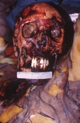Name:  animal%20feeding%20and%20dog%20claw%20abrasions1.jpg
Views: 7431
Size:  31.7 KB