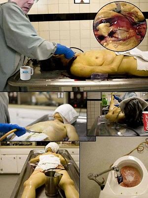 embalming_set.jpg