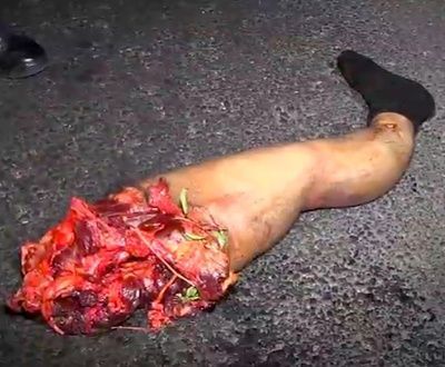 man-20dismembered-20and-20scattered-20along-20the-20road-2001.jpg