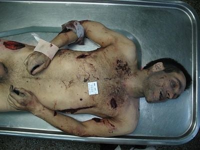 man-20in-20morgue.jpg