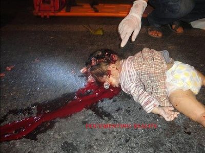 childs-20head-20crushed-20and-20eye-20popped-20out-20-281-29.jpg