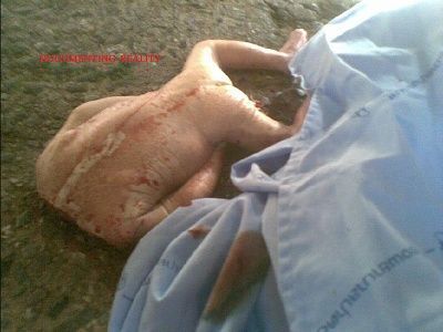 pregnant-20woman-20crushed-20by-20truck-20-horrific-20aftermath-20-284-29.jpg
