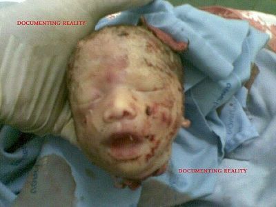 pregnant-20woman-20crushed-20by-20truck-20-horrific-20aftermath-20-285-29.jpg