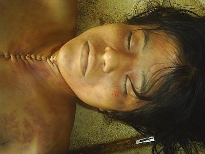 suicidal-20woman-20on-20the-20slab.jpg
