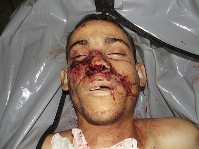 20-20yo-20man-20shot-20with-20nine-20rounds-2001.jpg