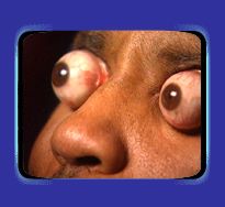 eye_pop.jpg