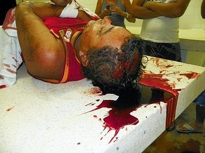 mototaxidriver-20lost-20control-20and-20died-2001.jpg