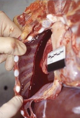 blood-20pooling-20-281-29.jpg