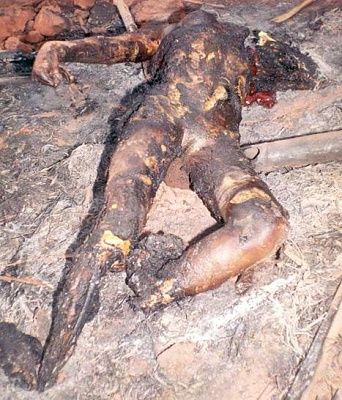 third-burnt-woman.jpg