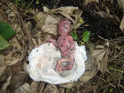 fetus-20-281-29.jpg