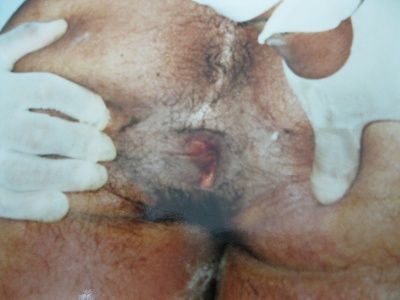raped-20amle-20-281-29.jpg