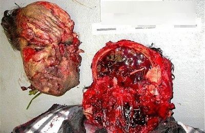 head.jpg
