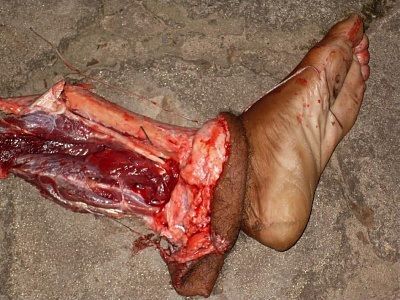 leg.jpg