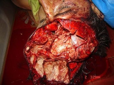 skull.jpg