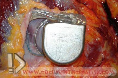 Name:  Image40.jpg
Views: 20669
Size:  39.9 KB
