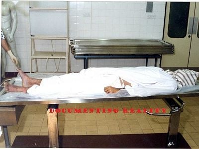 suicide-20hanging-20-281-29.jpg