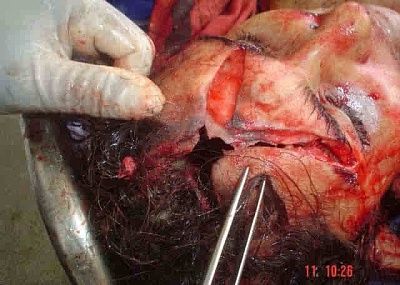 charonboat_dot_com_prostitute_shot_in_her_head_4.jpg