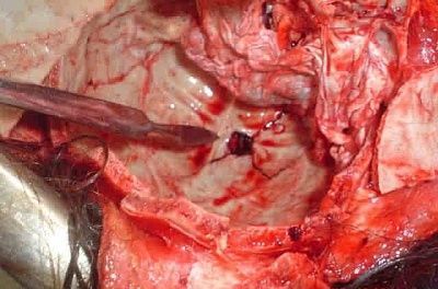 charonboat_dot_com_prostitute_shot_in_her_head_6.jpg