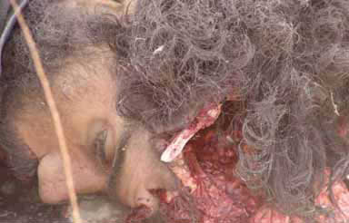 afghancasuheadwound.jpg