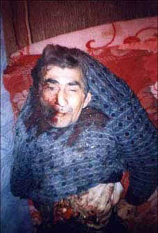 chechnyaExplosVictim.jpg