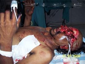 cranioSpinal1.jpg