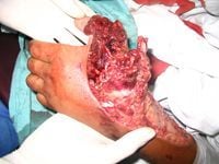hand.jpg
