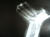 xray.jpg