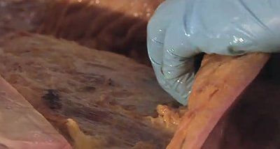 peeling-off-cadavers-skin-281-29.jpg