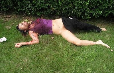 woman-throat-slashed.jpg