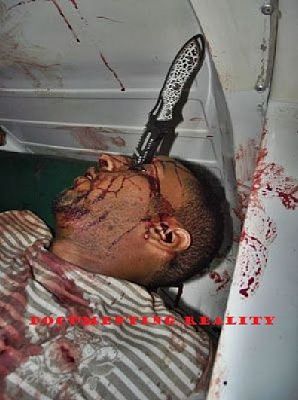stabbed-20in-20th-20e-20eye-20-281-29.jpg