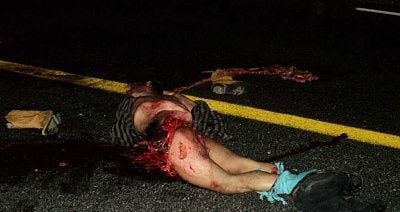 mexico-man-almost-cut-half-hit-run-driver-02.jpg