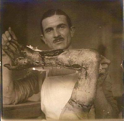 dude-morgue-showing-off-arm.jpg