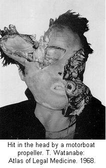 motorboat propeller death.jpg