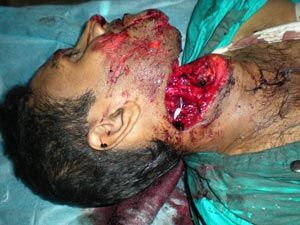 Name:  thr1.jpg
Views: 18412
Size:  22.4 KB