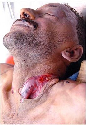 throatkill.jpg