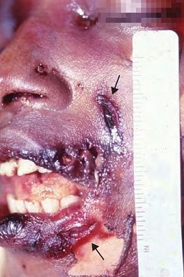 attacked-20with-20a-20lock-20in-20a-20tubesock1.jpg