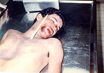 carbolic-20acid-20poisoning.jpg