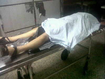 cadaver_450_339.jpg