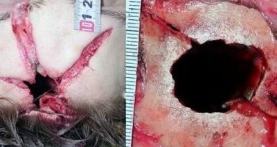 skull-20fracture.jpg