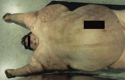 fatty.jpg