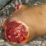 Dismembered04-150x150.jpg
